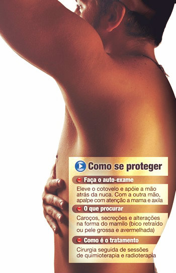 Câncer de mama em homens, causas, sintomas, tratamento, auto-exame.