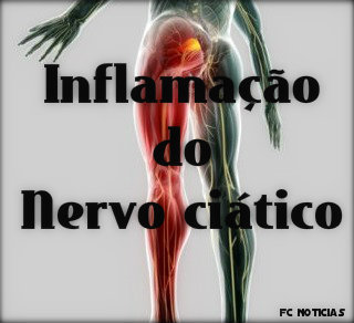 Inflamação do nervo ciático: causas, sintomas, tratamento e recomendações.