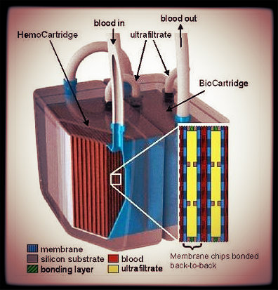 Como funcionam os rins artificiais?