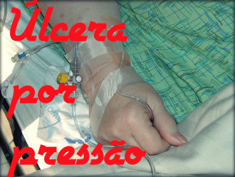Úlcera por pressão: causas, sintomas, tratamento e prevenção.