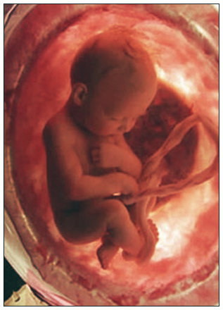 Cordão umbilical: formação, função, localização e curiosidades.