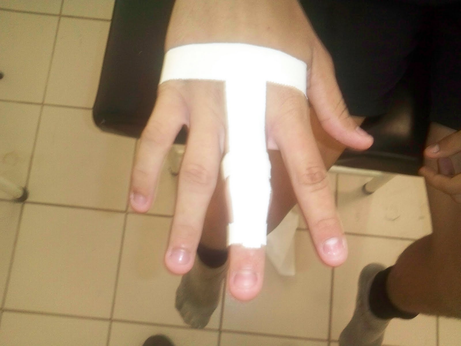 Tendinite no 3° dedo da mão