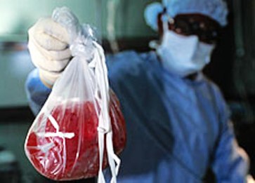 Motivos que vem ocasionando o intenso processo de tráfico de órgãos no mundo.