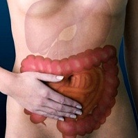 Doença de Crohn Doença de Crohn