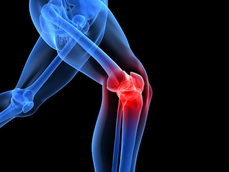 Carregar pesos em excesso é o fator principal para causar dor e lesão nos joelhos.